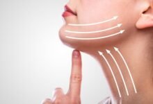 Double Chin Removal in Dubai