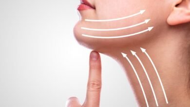 Double Chin Removal in Dubai